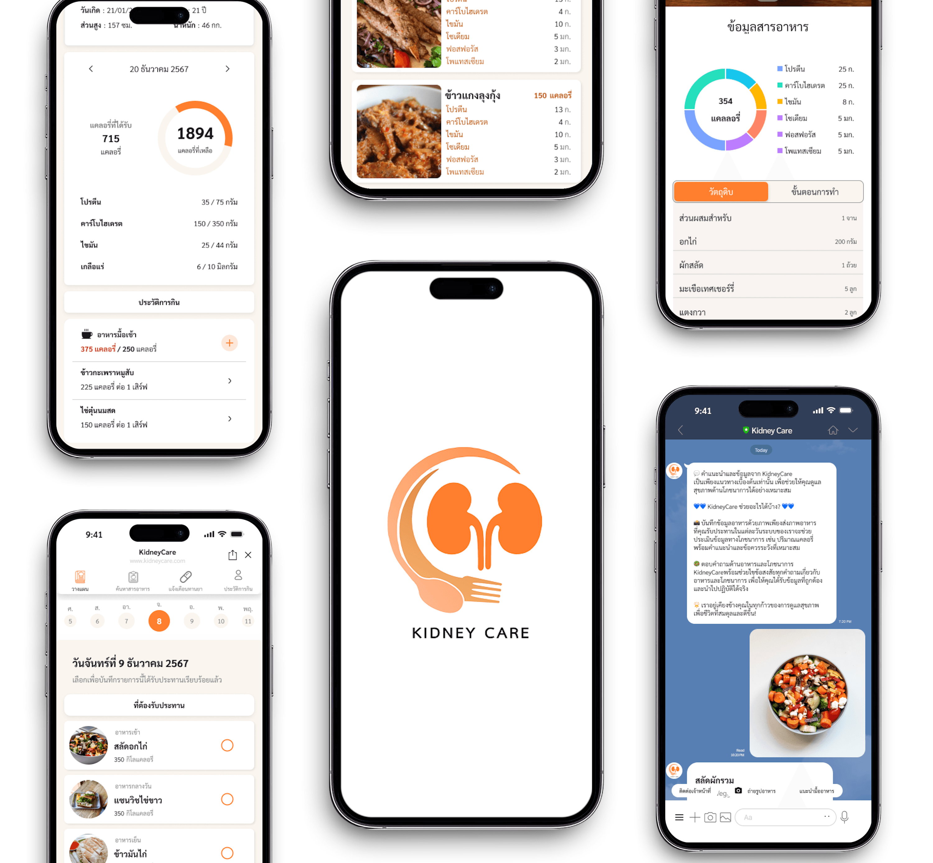 KidneyCare project preview